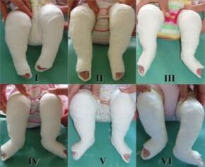 Procédures de lancer, dont chacune change la position du pied.