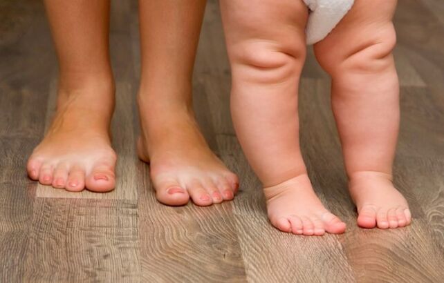 Déformation du pied valgus chez les enfants